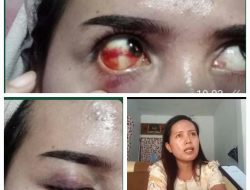 Pengeroyokan Oknum Istri Kades Sukosari Tetap Lanjut Laporan, Kades: Itu Sudah Kedua Kalinya Dilabrak, Polisi: Masih Lidik